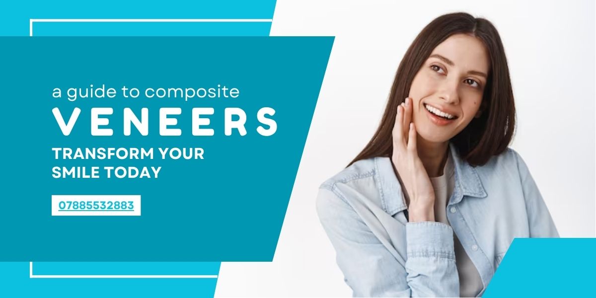 A Guide to Composite Veneers: Transform Your Smile Today 